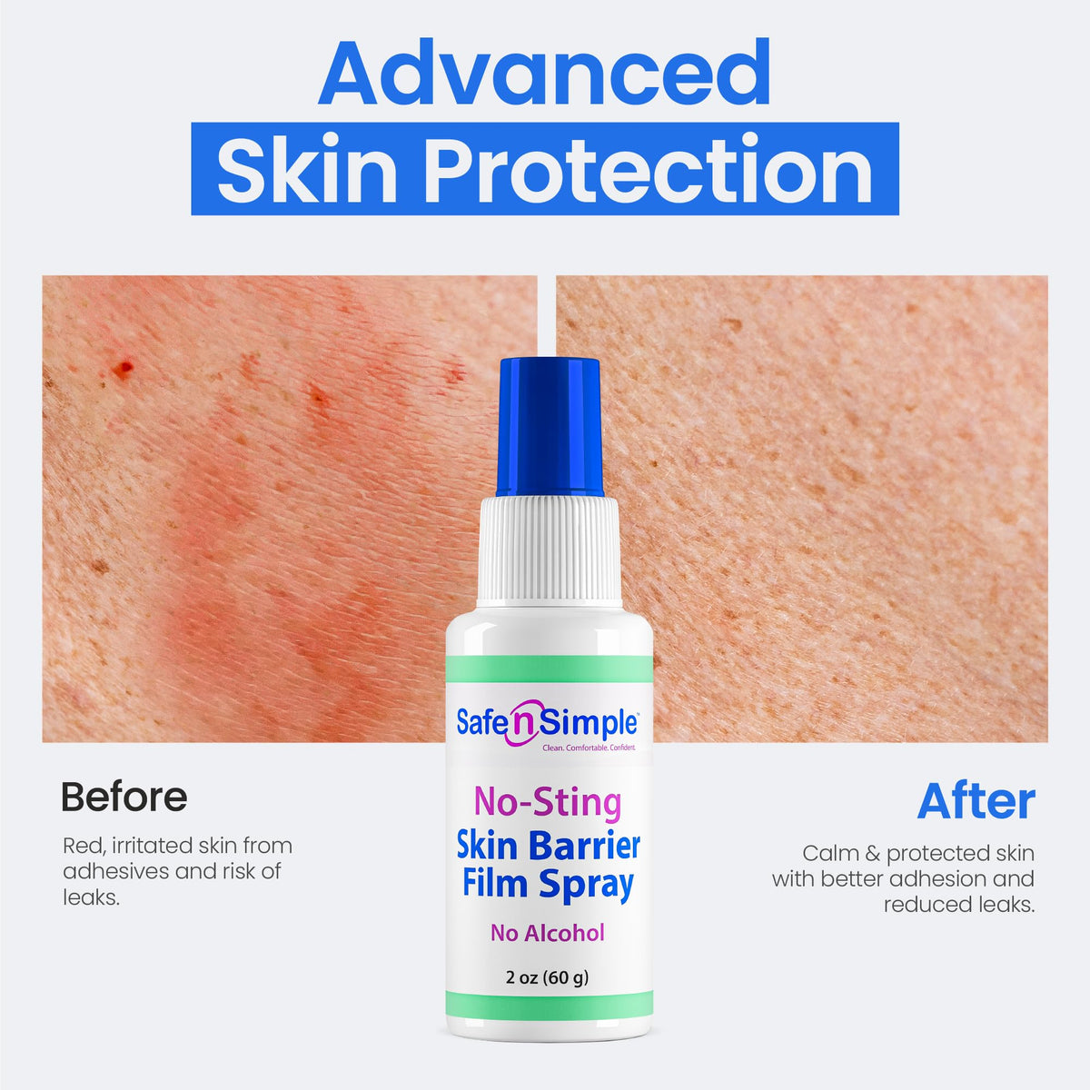 Skin Barrier Spray 2oz Alcohol-Free R765